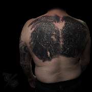 Totally Skin - GALLERY