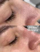 Virtuose Kosmetik - GALLERY
