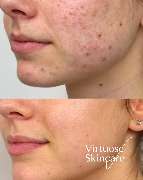 Virtuose Kosmetik - GALLERY