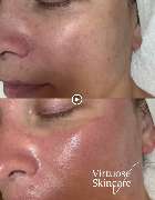 Virtuose Kosmetik - GALLERY