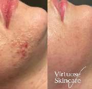 Virtuose Kosmetik - GALLERY
