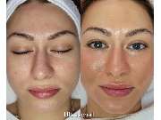 Visage Cosmetic & Skin Spa - GALLERY