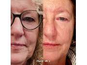 Visage Cosmetic & Skin Spa - GALLERY