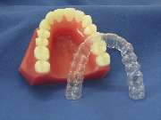 Zahnarzt Chrisoula Maroulidou - Invisalign