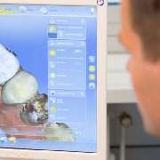 CEREC Zahnersatz (3D)