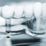 Zahnrath // Dr. Westerich Aesthetics - Zahnrath // Dr. Westerich Aesthetics