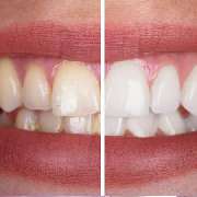 Zahnrath // Dr. Westerich Aesthetics - Zahnrath // Dr. Westerich Aesthetics